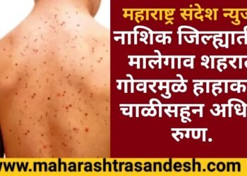 नाशिक जिल्ह्यातील मालेगाव शहरात गोवरने हाहाकार माजविल्या, आता पर्यंत चाळीसहून अधिक रुग्ण.