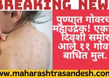 पुण्यात गोवरचा महाउद्रेक! एकाच दिवशी समोर आले 11 गोवर बाधित मुल.