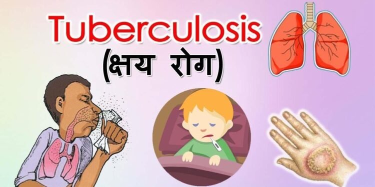 वर्धा जिल्ह्यात क्षयरुग्ण शोध मोहिमेस प्रारंभ, 1 लाख 33 हजार लोकसंख्येंची घरोघरी जाऊन तपासणी.