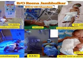 भंडारा: 860 ग्राम नवजात शिशुंसाठी ठरले वरदान सामान्य रूग्णालयातील एसएनसीयु युनिट