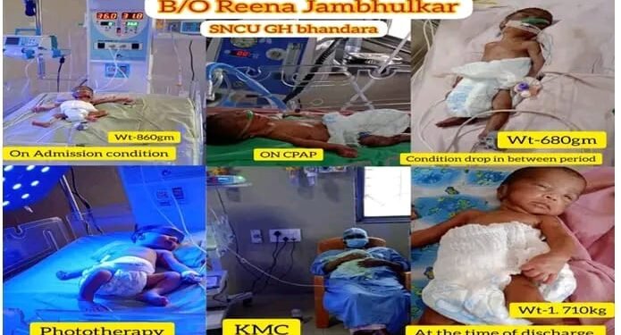 भंडारा: 860 ग्राम नवजात शिशुंसाठी ठरले वरदान सामान्य रूग्णालयातील एसएनसीयु युनिट