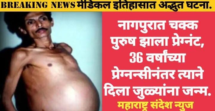 नागपुरात चक्क पुरुष झाला प्रेग्नंट, 36 वर्षांच्या प्रेग्नन्सीनंतर त्याने दिला जुळ्यांना जन्म. मेडिकल इतिहासात अद्भुत घटना.