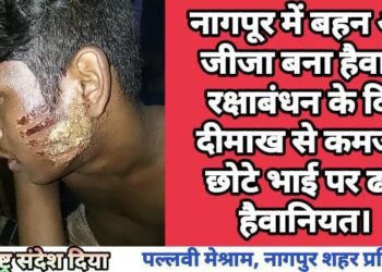 नागपूर में बहन और जीजा बना हैवान, रक्षाबंधन के दिन दीमाख से कमजोर छोटे भाई पर ढाई हैवानियत।