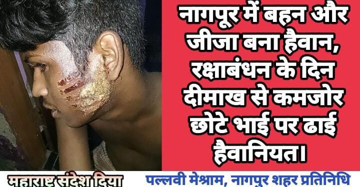 नागपूर में बहन और जीजा बना हैवान, रक्षाबंधन के दिन दीमाख से कमजोर छोटे भाई पर ढाई हैवानियत।