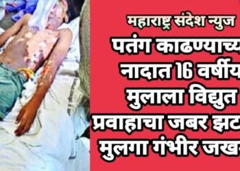पतंग काढण्याच्या नादात 16 वर्षीय मुलाला विद्युत प्रवाहाचा जबर झटका, मुलगा गंभीर जखमी.