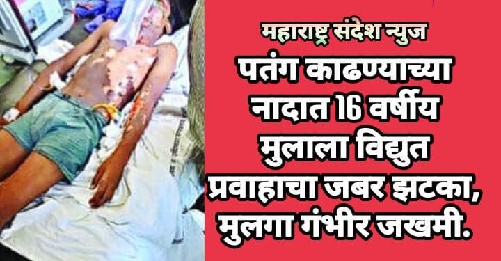 पतंग काढण्याच्या नादात 16 वर्षीय मुलाला विद्युत प्रवाहाचा जबर झटका, मुलगा गंभीर जखमी.