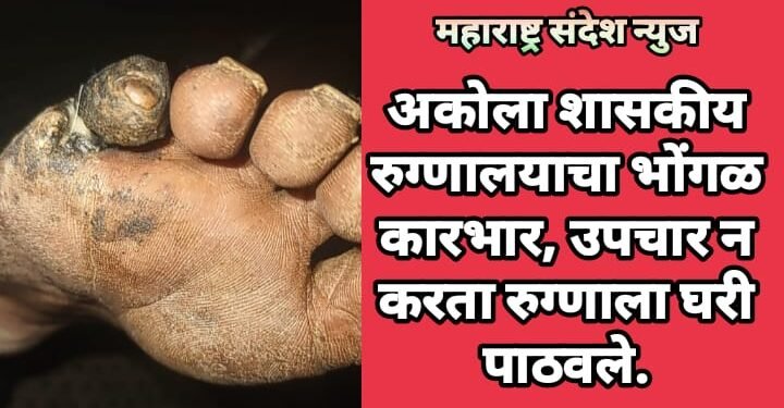 अकोला शासकीय रुग्णालयाचा भोंगळ कारभार, उपचार न करता रुग्णाला घरी पाठवले.