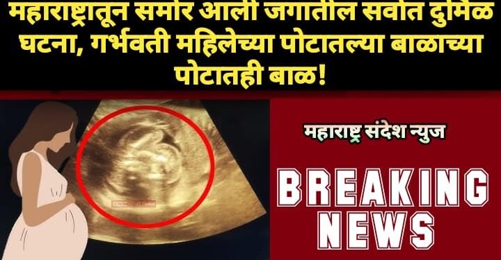 महाराष्ट्रातून समोर आली जगातील सर्वात दुर्मिळ घटना, गर्भवती महिलेच्या पोटातल्या बाळाच्या पोटातही बाळ!